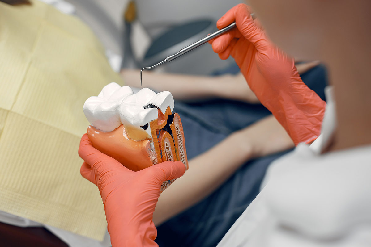 como-saber-si-tengo-una-caries-en-una-muela